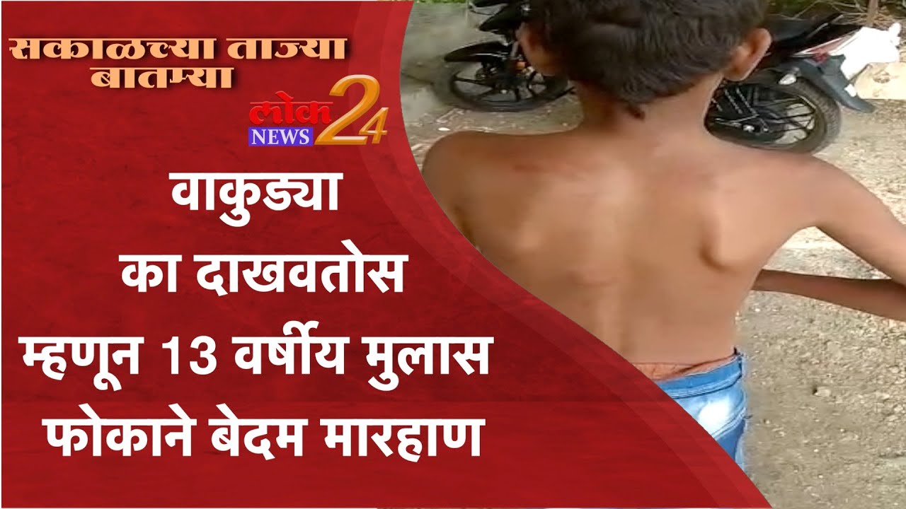 वाकुड्या का दाखवतोस म्हणून 13 वर्षीय मुलास  फोकाने बेदम मारहाणl  LokNews24